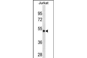 ARSA Antibody (C-term) (ABIN1536617 and ABIN2843873) western blot analysis in Jurkat cell line lysates (35 μg/lane). (Arylsulfatase A 抗体  (C-Term))