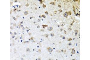 Immunohistochemistry of paraffin-embedded Mouse brain using CPA6 Polyclonal Antibody at dilution of 1:100 (40x lens). (CPA6 抗体)