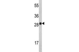 Western blot analysis of IL-2 antibody and MDA-MB231 lysate. (IL-2 抗体  (AA 50-77))
