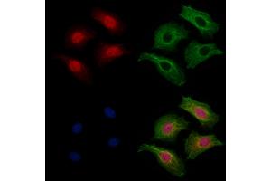 ABIN7094371 and ABIN7098418 staining HepG2 cells by IF/ICC.