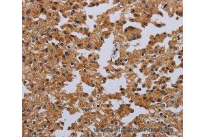 Immunohistochemistry of Human brain  using IFRD1 Polyclonal Antibody at dilution of 1:40 (IFRD1 抗体)