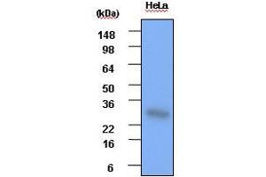 Western blot analysis: Cell lysates of HeLa(each 30ug) were resolved by SDS-PAGE, transferred to PVDF membrane and probed with anti-human Hsp27 (1:1000). (HSP27 抗体)