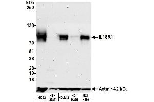 Western Blotting (WB) image for anti-Interleukin 18 Receptor 1 (IL18R1) (AA 25-329) antibody (ABIN7449352)