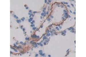 Used in DAB staining on fromalin fixed paraffin- embedded Kidney tissue (VIPR1 抗体  (AA 34-146))