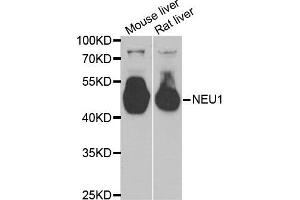 Western Blotting (WB) image for anti-Sialidase 1 (Lysosomal Sialidase) (NEU1) antibody (ABIN1980315) (NEU1 抗体)