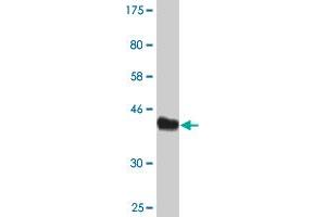 Western Blot detection against Immunogen (44. (AGR2 抗体  (AA 1-175))