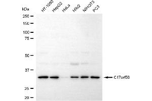 Western blotting analysis using c17orf58 antibody (ABIN7798076). (C17orf58 抗体)