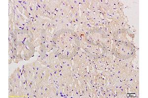 Formalin-fixed and paraffin embedded mouse myocardium labeled with Anti-Myoglobin Polyclonal Antibody, Unconjugated (ABIN704381) at 1:200 followed by conjugation to the secondary antibody and DAB staining. (Myoglobin 抗体  (AA 21-120))