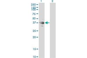 Western Blot analysis of TSSK2 expression in transfected 293T cell line by TSSK2 monoclonal antibody (M01), clone 1E12. (TSSK2 抗体  (AA 1-358))