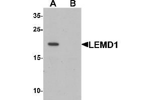 Western blot analysis of LEMD1 in A20 cell lysate with LEMD1 antibody at 1 µg/mL in (A) the absence and (B) the presence of blocking peptide. (LEMD1 抗体  (Middle Region))
