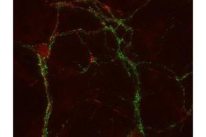 Indirect immunostaining of PFA fixed cultured hippocampus neurons with anti-SV2 C (dilution 1 : 500; red) and mouse anti-synapsin 1 (cat. (SV2C 抗体)