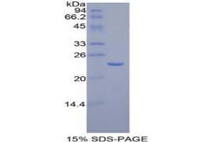 SDS-PAGE analysis of Mouse AGER Protein. (RAGE 蛋白)