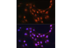 Immunofluorescence analysis of C6 cells using GMFB Rabbit pAb (ABIN6131732, ABIN6141181, ABIN6141182 and ABIN6224741) at dilution of 1:100 (40x lens). (GMFB 抗体  (AA 1-140))