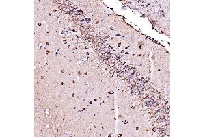 IHC analysis of ORP150/HYOU1 using anti-ORP150/HYOU1 antibody (ABIN7601807). (HYOU1 抗体  (AA 46-913))