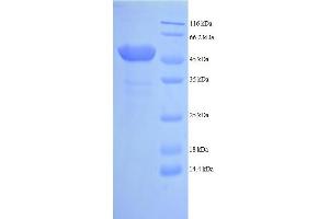 Angiopoietin 2 (ANGPT2) (AA 19-496) protein (His tag) expressed in yeast