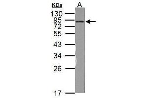 Western Blotting (WB) image for anti-NADH Dehydrogenase (Ubiquinone) Fe-S Protein 1, 75kDa (NADH-Coenzyme Q Reductase) (NDUFS1) (Center) antibody (ABIN2856931)
