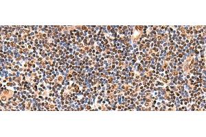 Immunohistochemistry of paraffin-embedded Human tonsil tissue using GPKOW Polyclonal Antibody at dilution of 1:140(x200) (GPKOW 抗体)