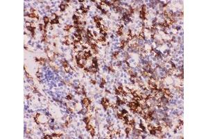 IHC-P staining of mouse spleen tissue (MYD88 抗体  (AA 44-264))