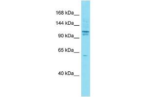 Host:  Rabbit  Target Name:  Axin1  Sample Type:  Mouse Testis lysates  Antibody Dilution:  1. (Axin 抗体  (N-Term))