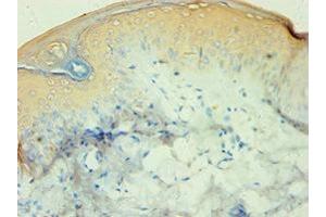 Immunohistochemistry of paraffin-embedded human skin tissue using ABIN7146502 at dilution of 1:100
