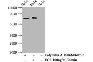 Western Blot Positive WB detected in Hela whole cell lysate(treated with Calyculin A or EGF) All lanes Phospho-RAF1 antibody at 1. (Recombinant RAF1 抗体  (pSer621))