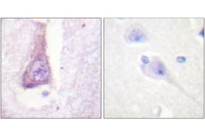 Immunohistochemistry analysis of paraffin-embedded human brain tissue, using WASP (Ab-290) Antibody. (WASP 抗体  (AA 256-305))
