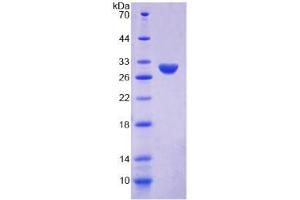 SDS-PAGE analysis of Human Ki-67 Protein. (Ki-67 蛋白)