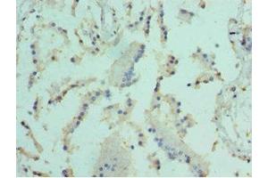 Immunohistochemistry of paraffin-embedded human prostate tissue using ABIN7152098 at dilution of 1:100 (Elf4 抗体  (AA 1-200))