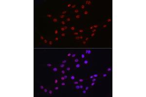 Immunofluorescence analysis of PC-12 cells using DDX39A antibody (ABIN6131590, ABIN6139489, ABIN6139491 and ABIN6223963) at dilution of 1:50.