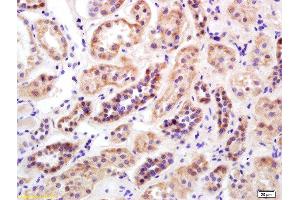Formalin-fixed and paraffin embedded human kidney labeled with Rabbit Anti Mitofusin 2/MFN2 Polyclonal Antibody, Unconjugated  at 1:200 followed by conjugation to the secondary antibody and DAB staining (MFN2 抗体  (AA 1-120))