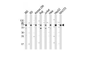 Western Blot at 1:2000 dilution Lane 1: 293 whole cell lysate Lane 2: RD whole cell lysate Lane 3: Karpas 299 whole cell lysate Lane 4: Raji whole cell lysate Lane 5: Jurkat whole cell lysate Lane 6: Hela whole cell lysate Lane 7: HepG2 whole cell lysate Lane 8: NIH/3T3 whole cell lysate Lysates/proteins at 20 ug per lane. (IGF2BP1 抗体  (C-Term))