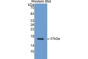 Detection of Recombinant HK1, Rat using Polyclonal Antibody to Hexokinase 1 (HK1) (Hexokinase 1 抗体  (AA 80-215))
