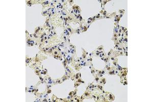 Immunohistochemistry of paraffin-embedded rat lung using GTF2H2 antibody (ABIN5975366) at dilution of 1/100 (40x lens). (GTF2H2 抗体)