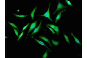 Immunofluorescence staining of Hela cells with ABIN7157491 at 1:133, counter-stained with DAPI. (KIF1BP 抗体  (AA 24-204))