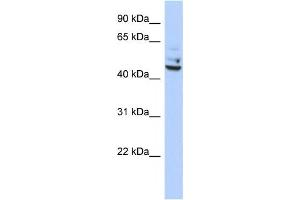Western Blotting (WB) image for anti-Tumor Protein P53 Inducible Protein 13 (TP53I13) antibody (ABIN2459492) (TP53I13 抗体)