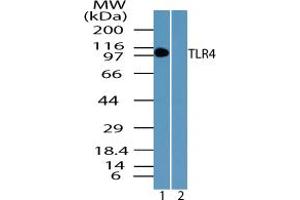 Image no. 1 for anti-Toll-Like Receptor 4 (TLR4) (AA 650-700) antibody (ABIN1491625) (TLR4 抗体  (AA 650-700))
