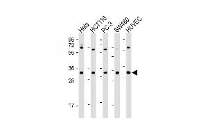 All lanes : Anti-TNFRSF6B Antibody (N-term) at 1:2000 dilution Lane 1: Hela whole cell lysate Lane 2: HC whole cell lysate Lane 3: PC-3 whole cell lysate Lane 4: S whole cell lysate Lane 5: HUVEC whole cell lysate Lysates/proteins at 20 μg per lane. (TNFRSF6B 抗体  (N-Term))