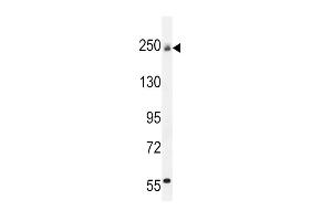 Western Blotting (WB) image for anti-Collagen, Type V, alpha 1 (COL5A1) (AA 54-82), (N-Term) antibody (ABIN654444)