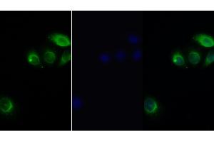 Detection of LEPR in Human Hela cell using Polyclonal Antibody to Leptin Receptor (LEPR) (Leptin Receptor 抗体  (AA 310-539))