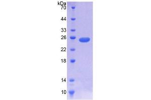 SDS-PAGE analysis of Human NOMO1 Protein. (NOMO1 蛋白)