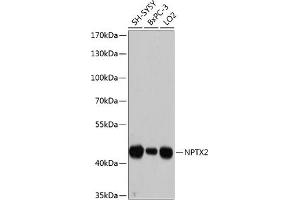 Western blot analysis of extracts of various cell lines, using NPTX2 antibody (ABIN6128350, ABIN6144791, ABIN6144792 and ABIN6215594) at 1:3000 dilution. (NPTX2 抗体  (AA 90-240))