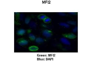 Sample Type: HeLa cells Primary Antibody Dilution: 1:50Secondary Antibody: Goat anti-rabbit-Alexa Fluor 488  Secondary Antibody Dilution: 1:000Color/Signal Descriptions: Green: MFI2Blue: DAPI  Gene Name: MFI2 Submitted by: COCOLA Cinzia, Stem Cell Biology and Cancer Research Unit (MFI2 抗体  (C-Term))