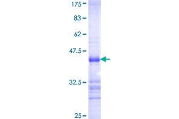 Casein Kinase 1 gamma 2 Protein (AA 315-415) (GST tag)