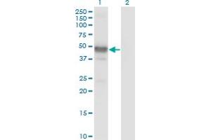 Western Blot analysis of LHX2 expression in transfected 293T cell line by LHX2 monoclonal antibody (M02), clone 1E6. (LHX2 抗体  (AA 1-76))