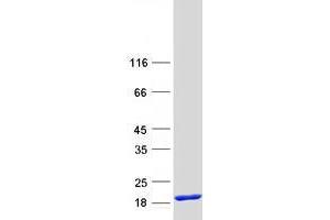 Western Blotting (WB) image for Trafficking Protein Particle Complex 1 (TRAPPC1) protein (Myc-DYKDDDDK Tag) (ABIN2734178)