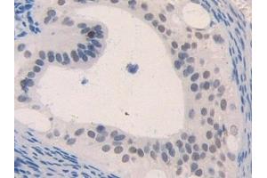 Detection of MIP1b in Mouse Ovary Tissue using Polyclonal Antibody to Macrophage Inflammatory Protein 1 Beta (MIP1b) (CCL4 抗体  (AA 24-92))