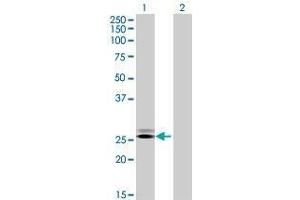 Lane 1: GRPEL2 transfected lysate ( 25.
