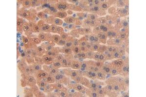 Immunohistochemistry (IHC) image for anti-ATP-Binding Cassette, Sub-Family F (GCN20), Member 1 (ABCF1) (AA 617-837) antibody (ABIN5013199)