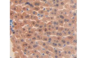 Used in DAB staining on fromalin fixed paraffin- embedded liver tissue (ABCF1 抗体  (AA 617-837))