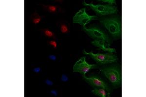ABIN6265848 and ABIN6277175 staining  cells by IF/ICC. (UBE2I 抗体  (N-Term))